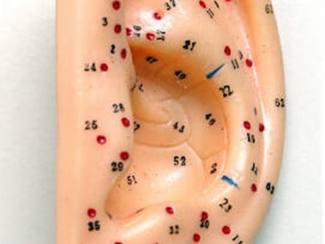 Auriculo Net Points.Auriculotherapie